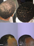 Natural Hair Growth Oil