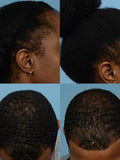 Natural Hair Growth Oil